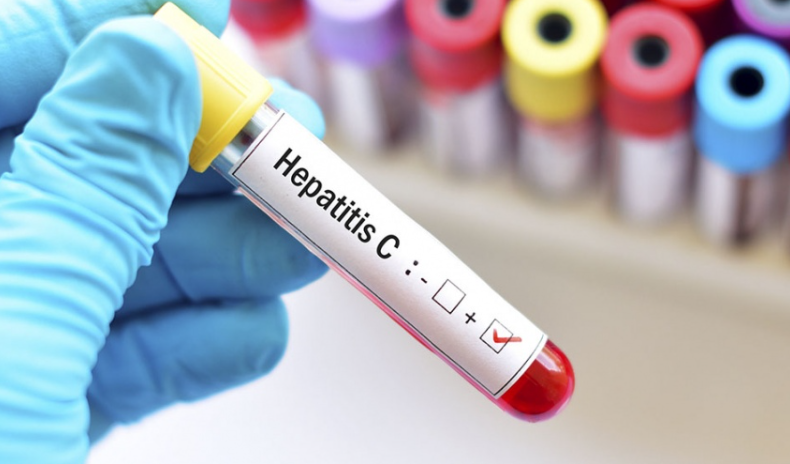 Solo el 18% de personas diagnosticadas con hepatitis B y C realizan tratamiento 