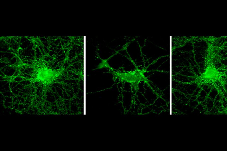 Importante avance científico argentino para combatir el Alzheimer